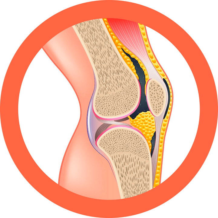 Hondroten stellt Gelenke und Muskeln wieder her.
