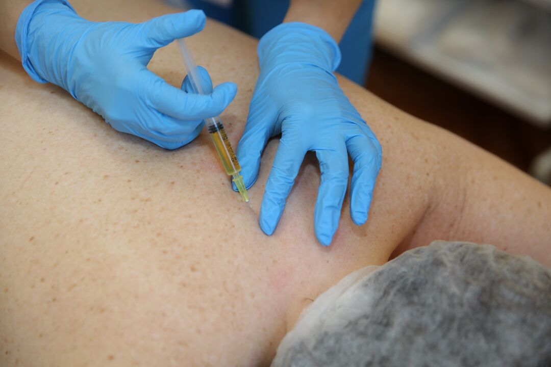 Chondroprotektor-Injektionen für den Rücken