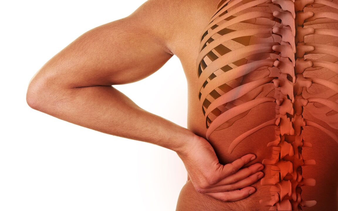 Symptome einer lumbalen Osteochondrose